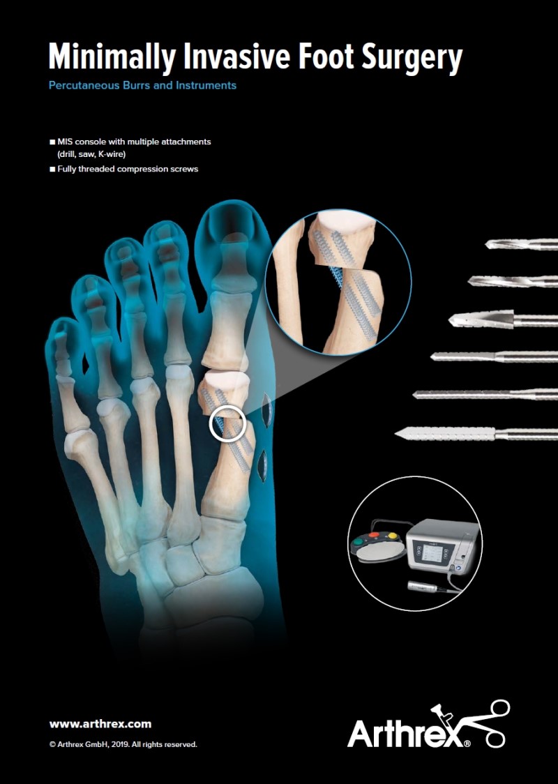 MedTec-Motiv Mai 20: Arthrex für MIS Minimal Invasive Foot Surgery